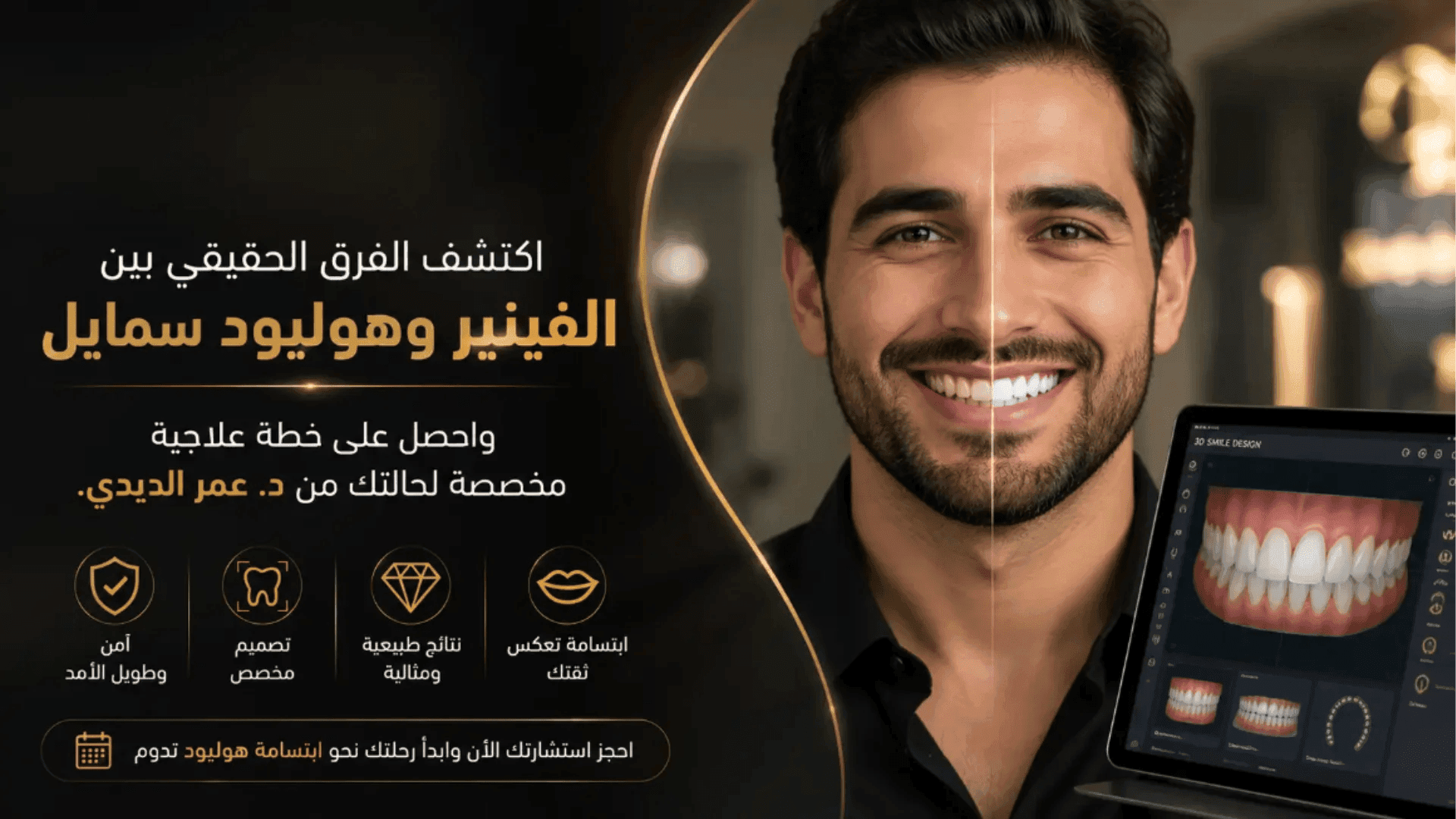 الفرق بين هوليود سمايل والفينير: وش الفرق الحقيقي وايش يناسبك؟